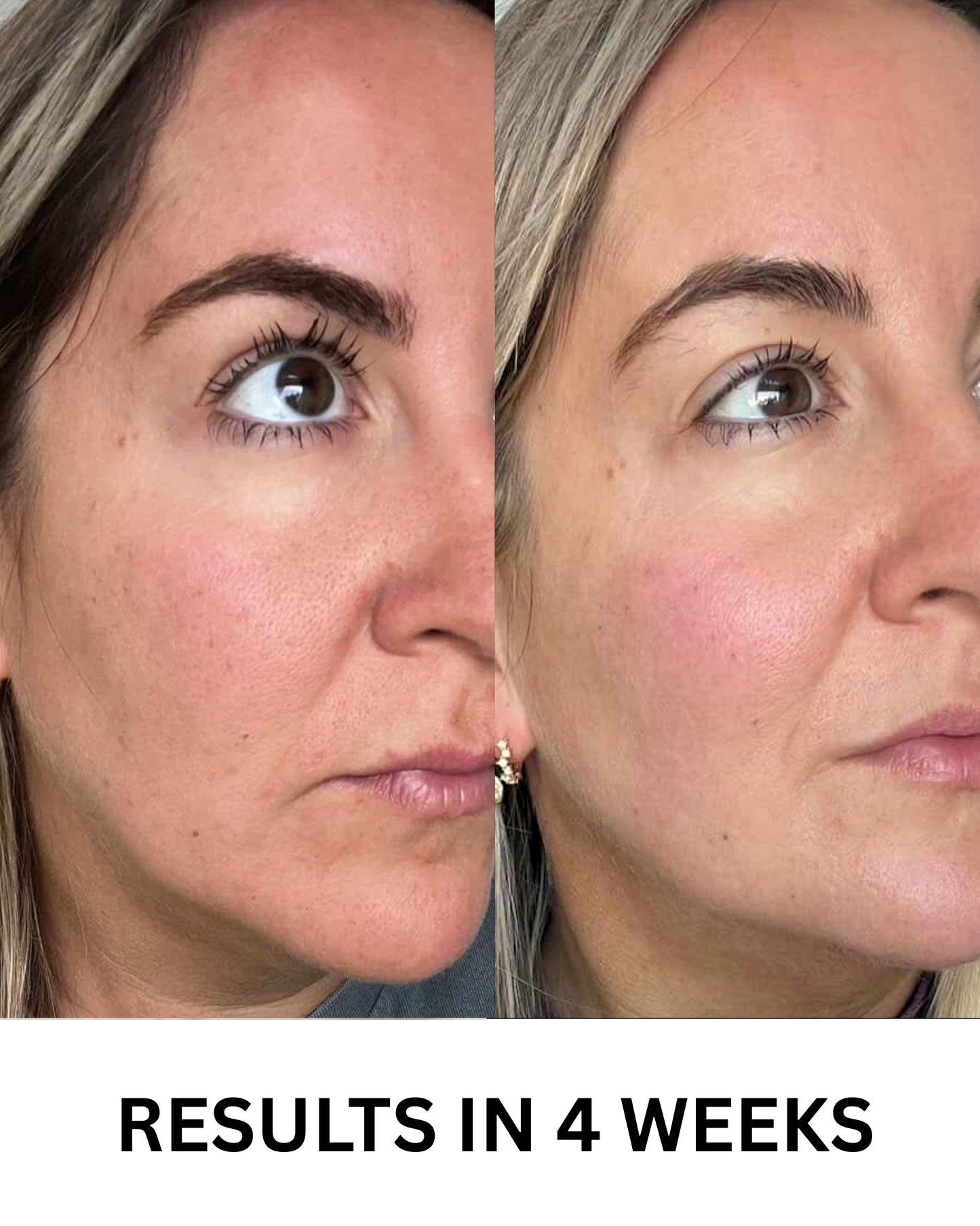 Vitamin C Serum 50ml